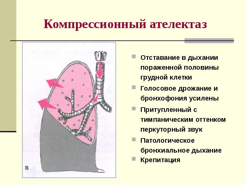 Презентация пропедевтика внутренних болезней дыхательная система