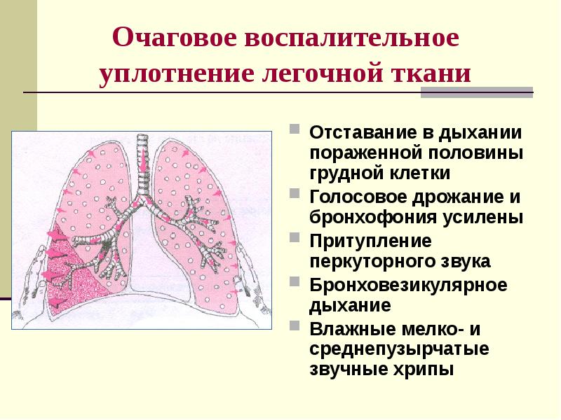 Презентация пропедевтика внутренних болезней дыхательная система