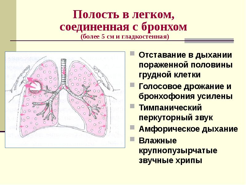 Презентация пропедевтика внутренних болезней дыхательная система