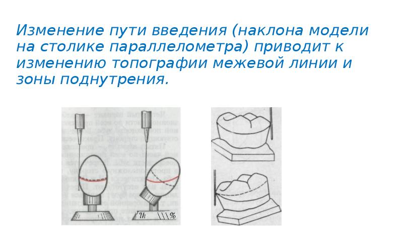 При переднем наклоне модели на столике параллелометра задний край модели