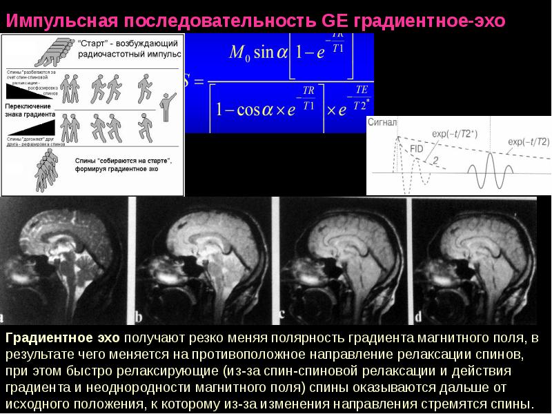 Схема мр томографа