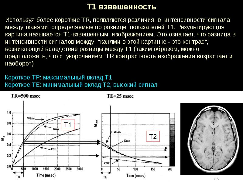 Мрт принцип работы схема