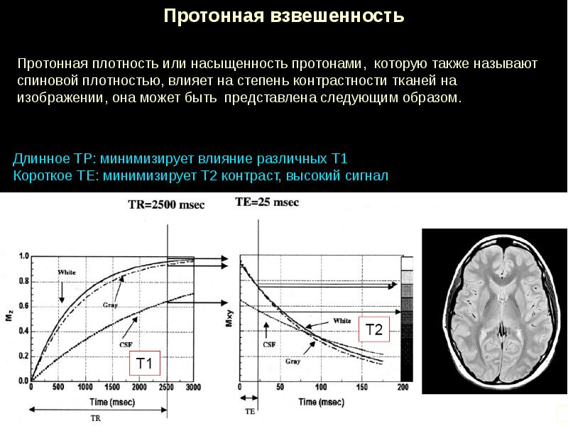 Физические основы мрт презентация