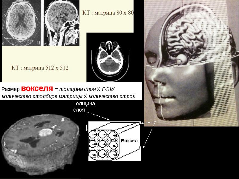 Физические основы мрт презентация