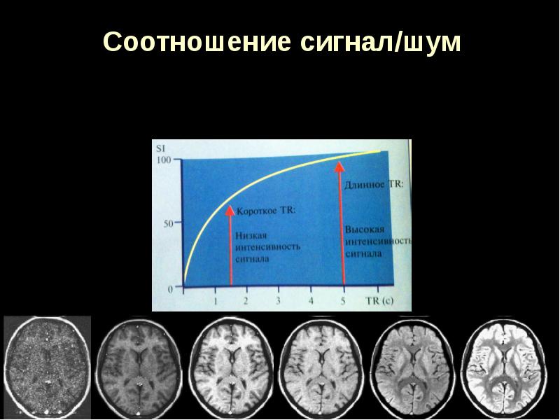 Режимы мрт. Основы мрт. Физические основы мрт. Физико технические основы мрт. Соотношение сигнал шум.