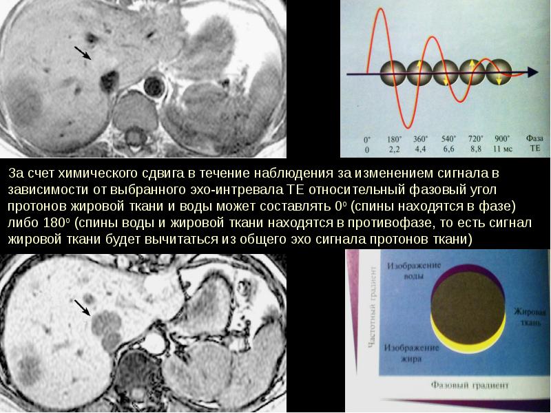 Физические основы мрт презентация