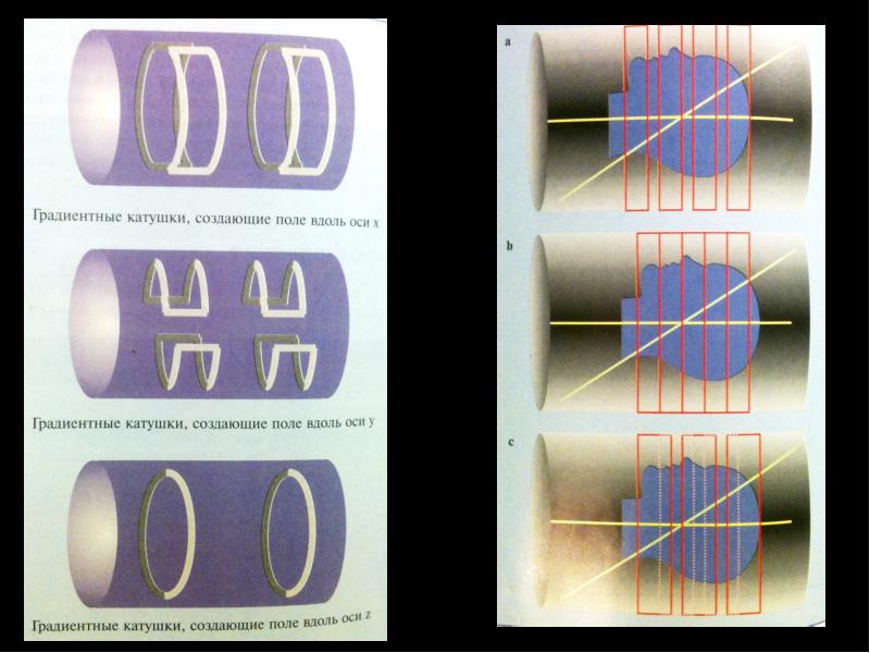 Система градиент. Принцип действия магнитно-резонансного томографа. Строение катушки мрт. Градиентные катушки мрт. Катушки для томографа.