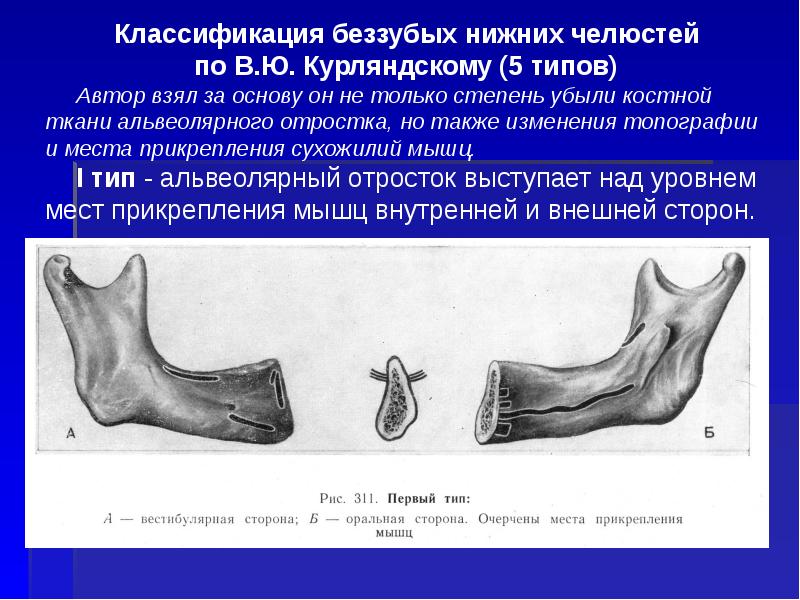 Ортопедические конструкции презентация