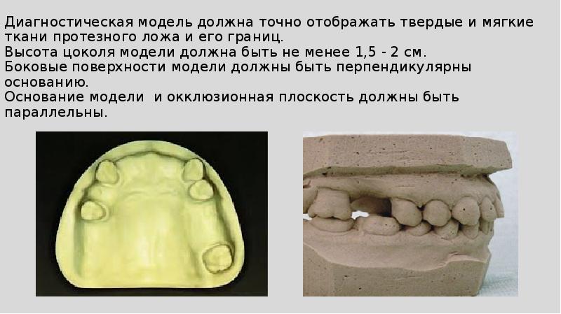 Протезное поле и протезное ложе. Позитивное отображение тканей протезного ложа это. Диагностические модели. Объективные методы исследования тканей протезного ложа.