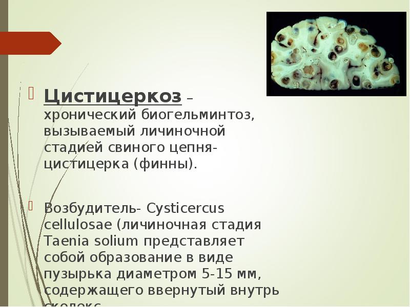Цистицеркоз – хронический биогельминтоз, вызываемый личиночной стадией свиного цепня- цистицерка (финны).