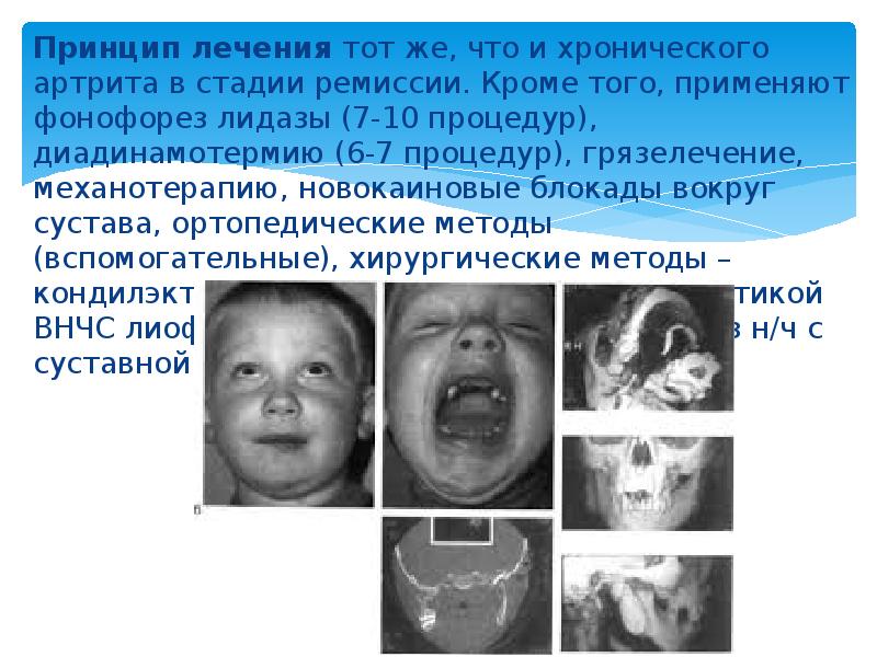 Детские болезни презентация