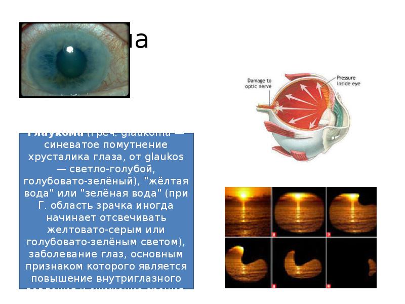 Зрительный анализатор проект