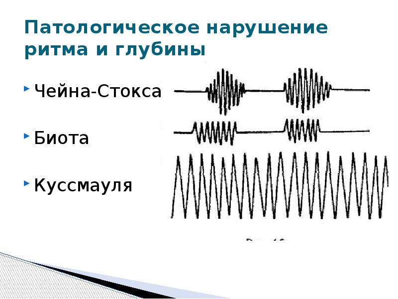 Патологическое дыхание. Дыхание Биота Чейна Стокса Куссмауля. Дыхание Грокка чейн-Стокса Биота Куссмауля это. Типы дыхания Куссмауля Чейна Стокса Биота. Дыхание Чейна Стокса.