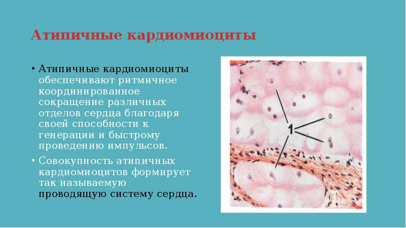 Атипичные кардиомиоциты рисунок