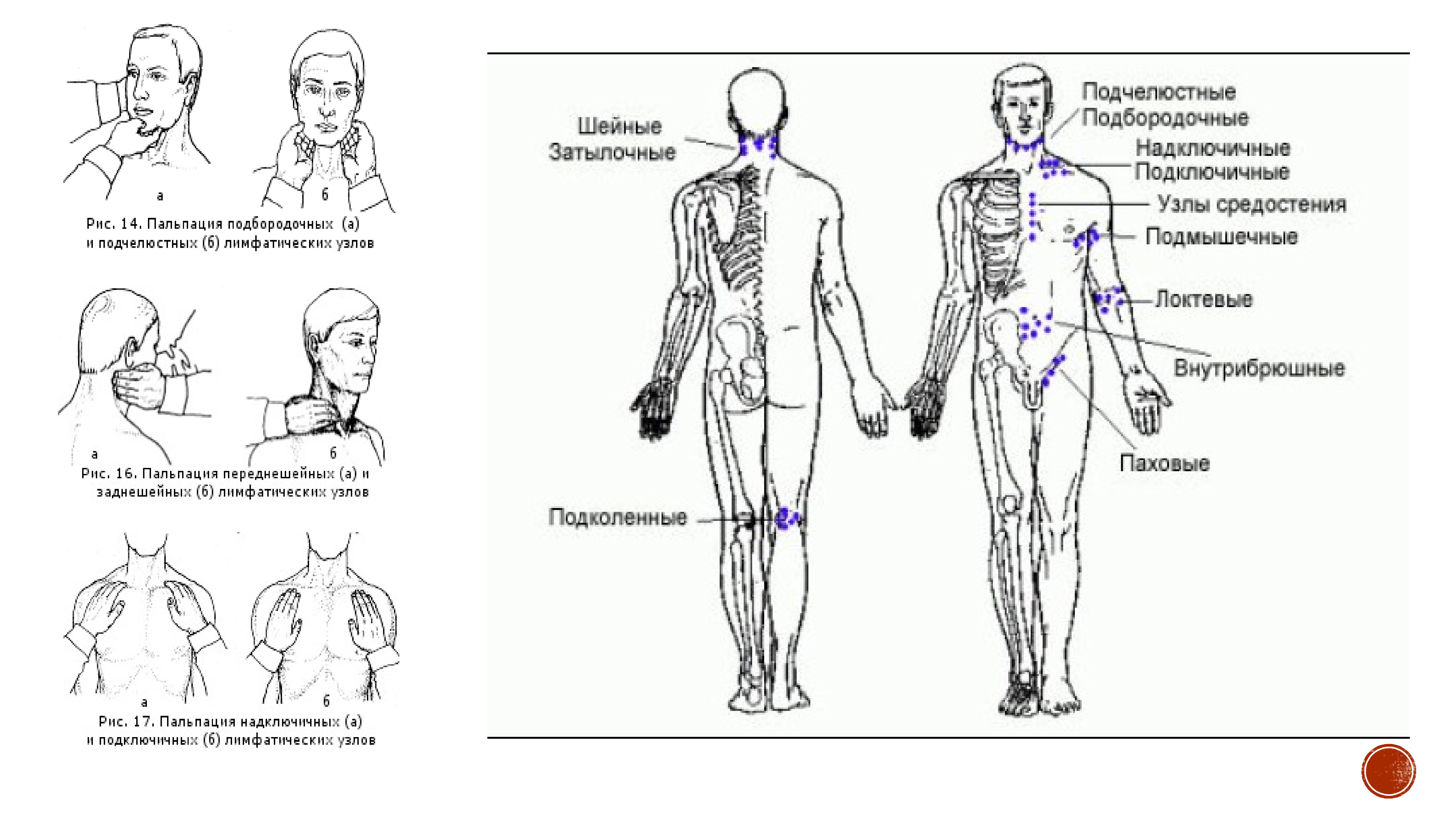 Лимфоузел справа у мужчины. Лимфатическая система ребенка схема. Лимфоузел схема на теле. Схема лимфатических узлов человека. Пальпация лимфоузлов схема.
