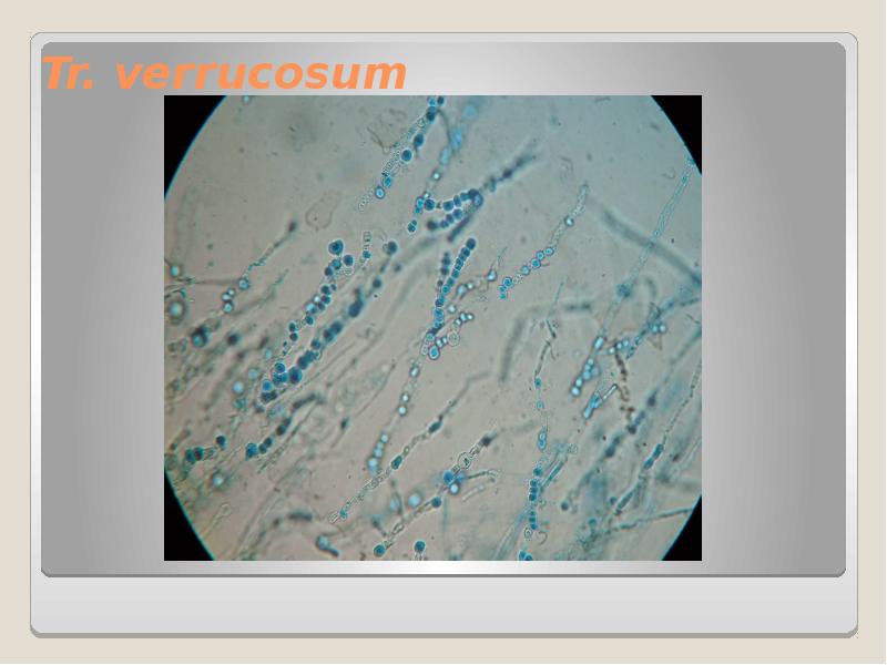 Tr. verrucosum Tr. verrucosum