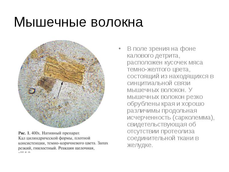 Что такое детрит в кале