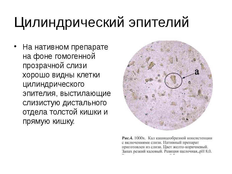 Клетки цилиндрического эпителия nilm