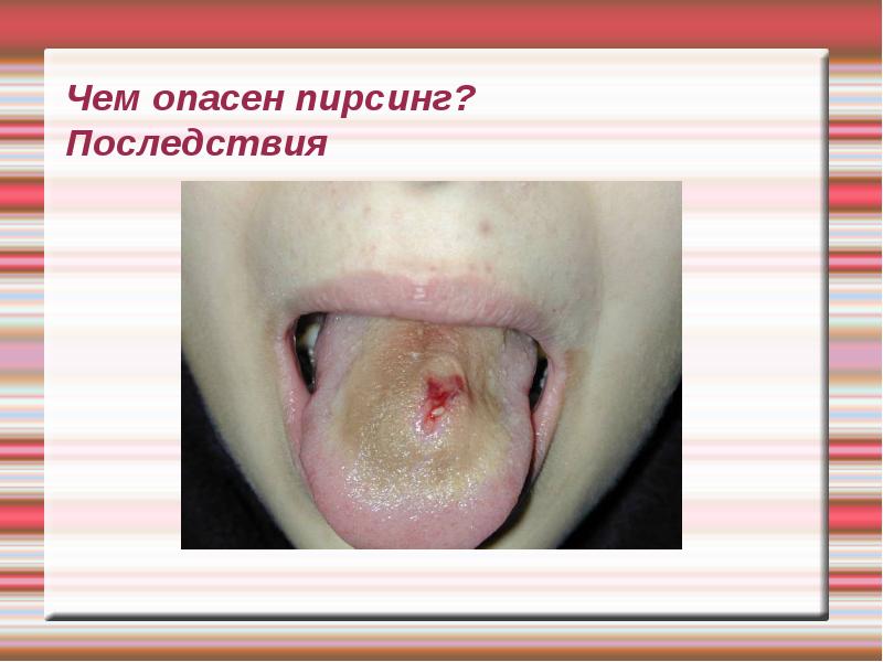 Чем опасен пирсинг? Последствия