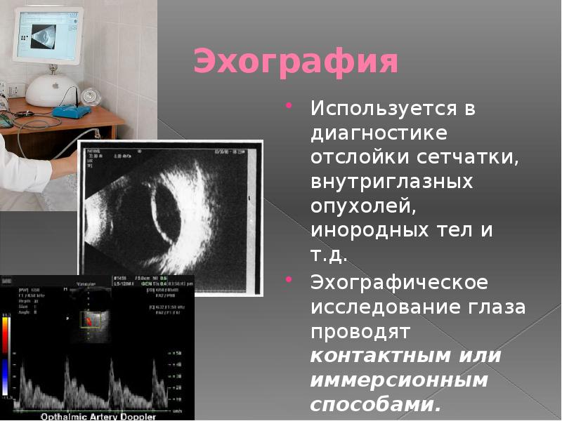 Методы исследования органа зрения презентация