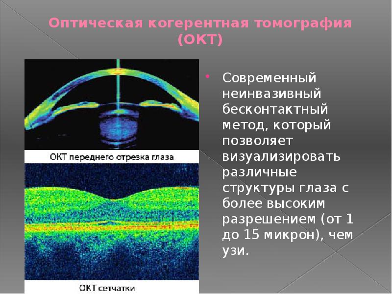 Методы исследования в офтальмологии презентация