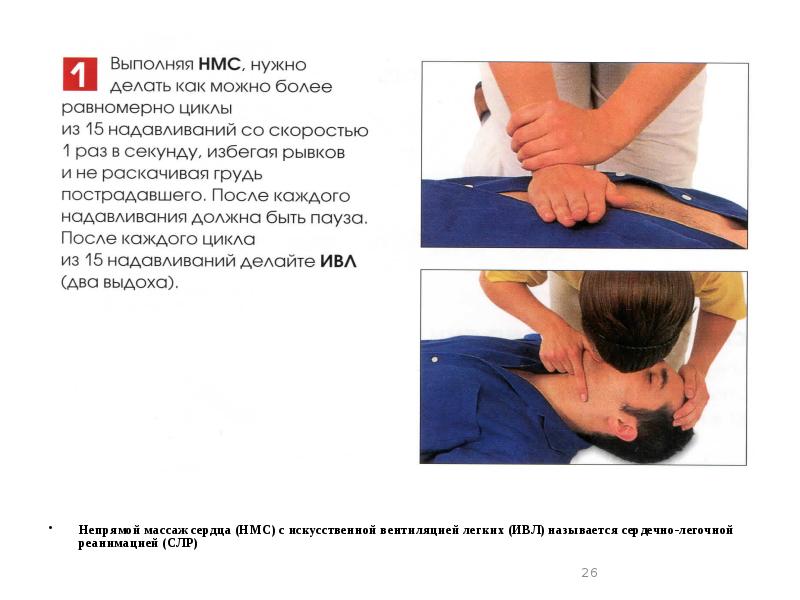 непрямой массаж сердца 1 человеком