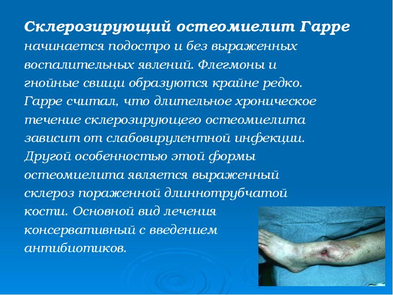 Склерозирующий остеомиелит Гарре
Склерозирующий остеомиелит Гарре
начинается подостро и без выраженных
Склерозирующий остеомиелит Гарре
Склерозирующий остеомиелит Гарре
начинается подостро и без выраженных