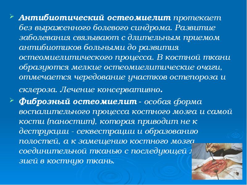 Антибиотический остеомиелит протекает без выраженного болевого синдрома. Развитие заболевания связывают с Антибиотический остеомиелит протекает без выраженного болевого синдрома. Развитие заболевания связывают с