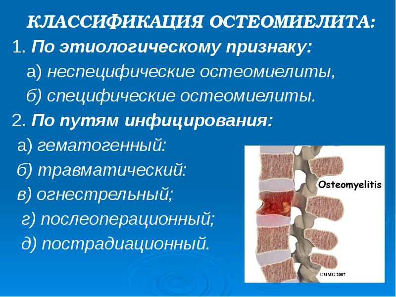 КЛАССИФИКАЦИЯ ОСТЕОМИЕЛИТА:
КЛАССИФИКАЦИЯ ОСТЕОМИЕЛИТА:
1. По этиологическому признаку:
КЛАССИФИКАЦИЯ ОСТЕОМИЕЛИТА:
КЛАССИФИКАЦИЯ ОСТЕОМИЕЛИТА:
1. По этиологическому признаку: