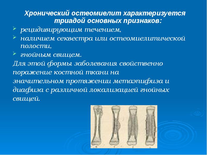 Хронический остеомиелит характеризуется триадой основных признаков:
Хронический остеомиелит характеризуется триадой Хронический остеомиелит характеризуется триадой основных признаков:
Хронический остеомиелит характеризуется триадой
