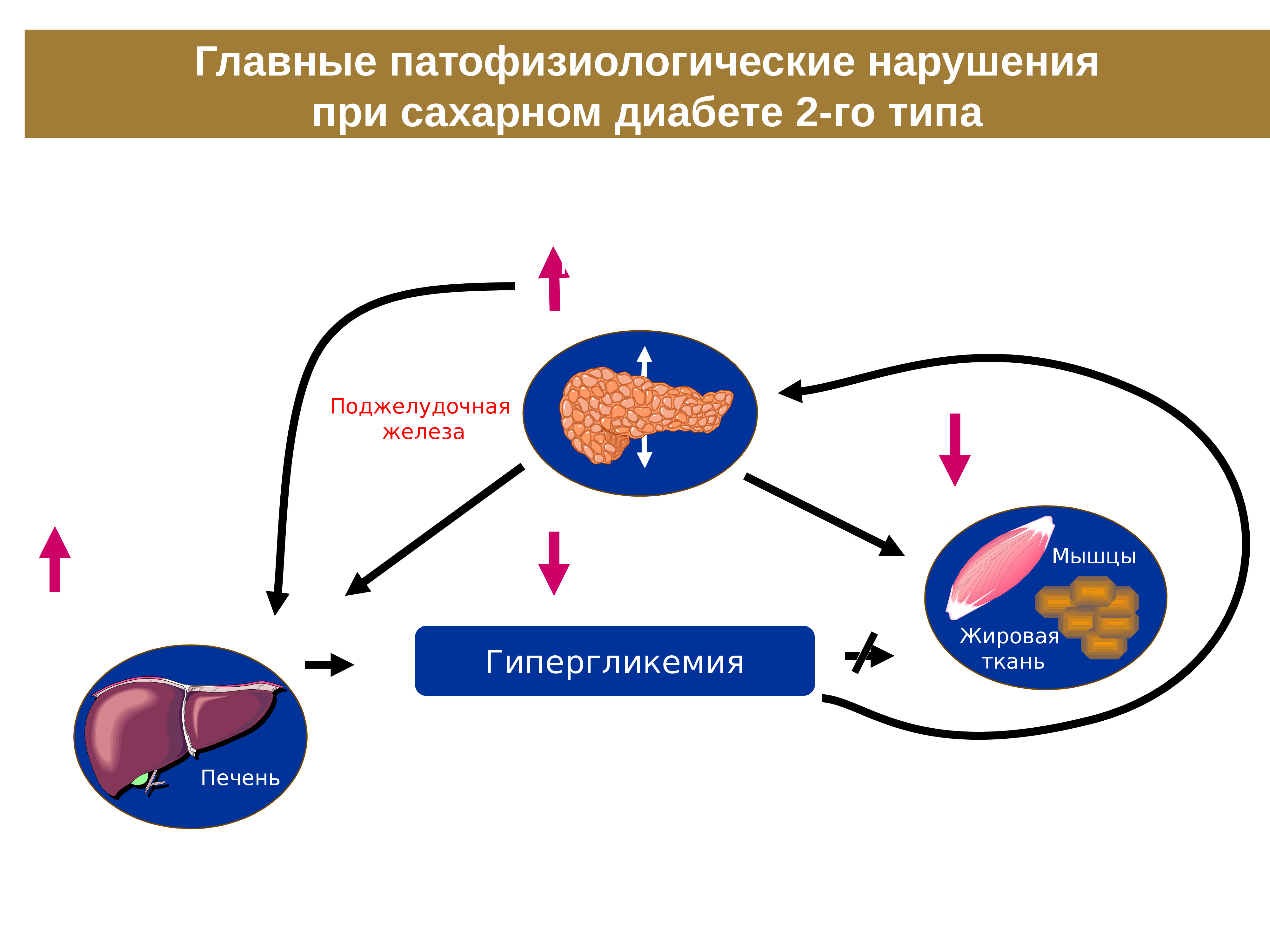 Вкр сахарный диабет презентация