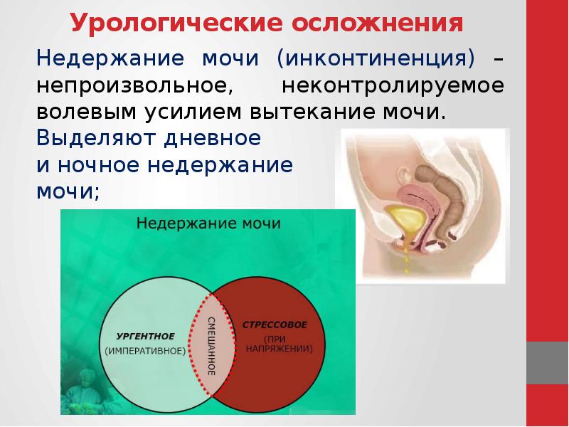 Мочиться Во Время Секса