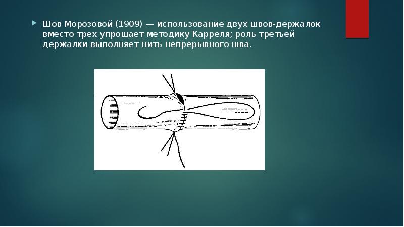 Сосудистый шов :: Сосудистая хирургия на современном …