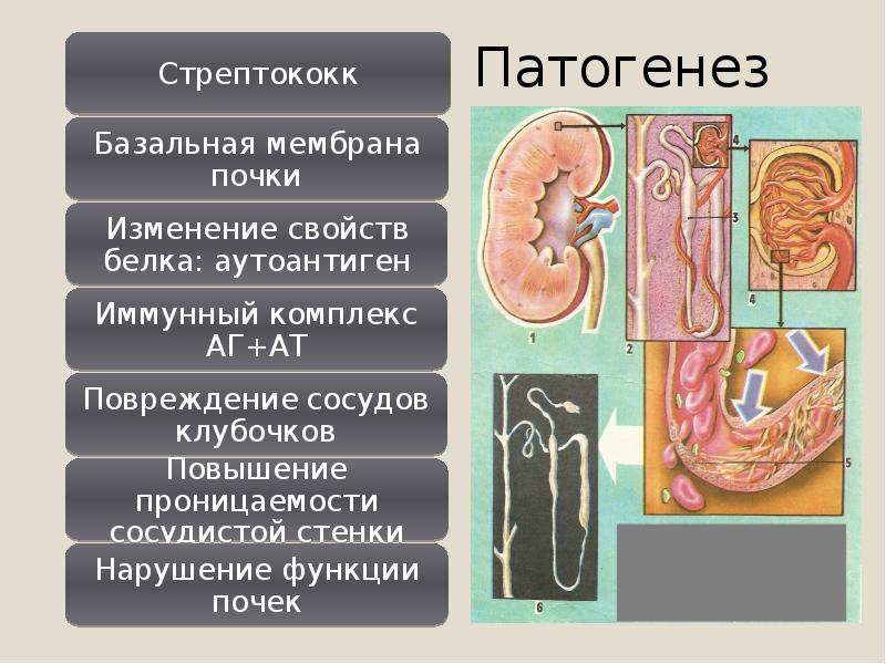 Нарушение стенки. Мембрана почки. Базальная мембрана почки. Базальная мембрана клубочка почки. Иммунное повреждение клубочков почек.