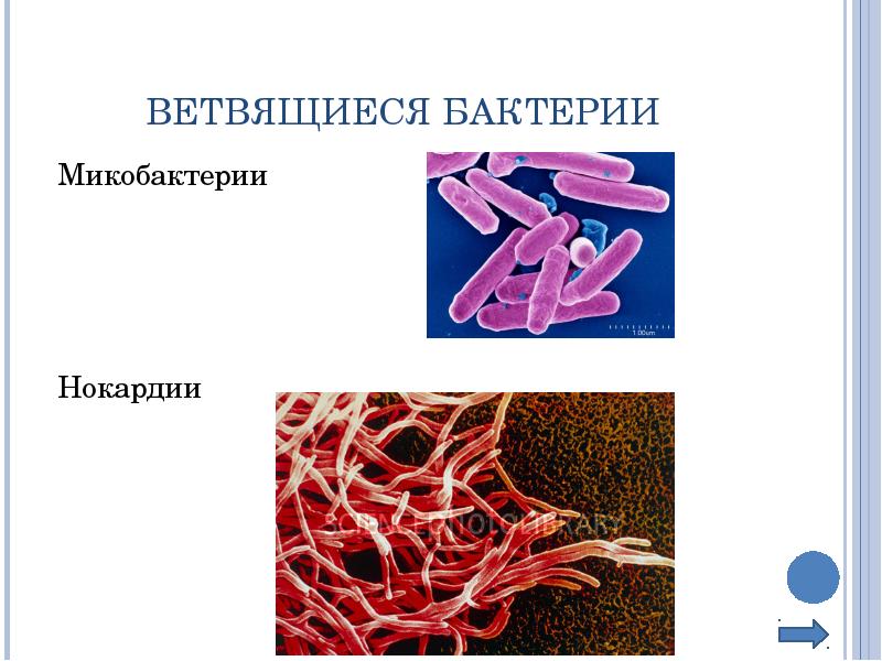 Нитевидные бактерии. Ветвящиеся формы бактерий. Ветвящиеся нитевидные формы бактерий. Ветвящиеся бактерии микобактерии. Ветвящиеся бактерии микробиология.