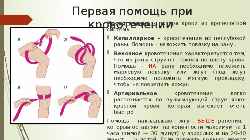 Презентация пп при кровотечениях