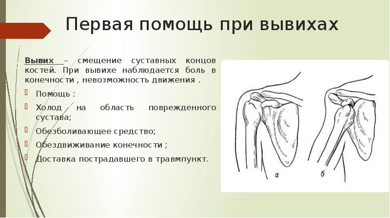 Вывих плеча презентация