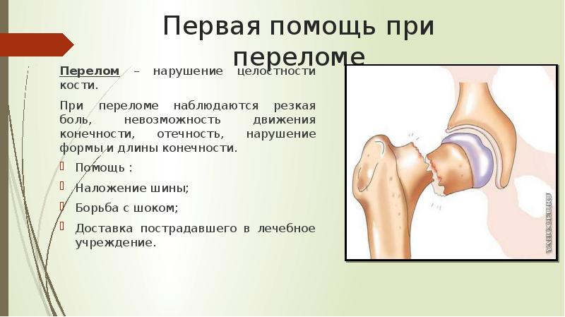 Меры по предупреждению переломов сбо 7 класс презентация