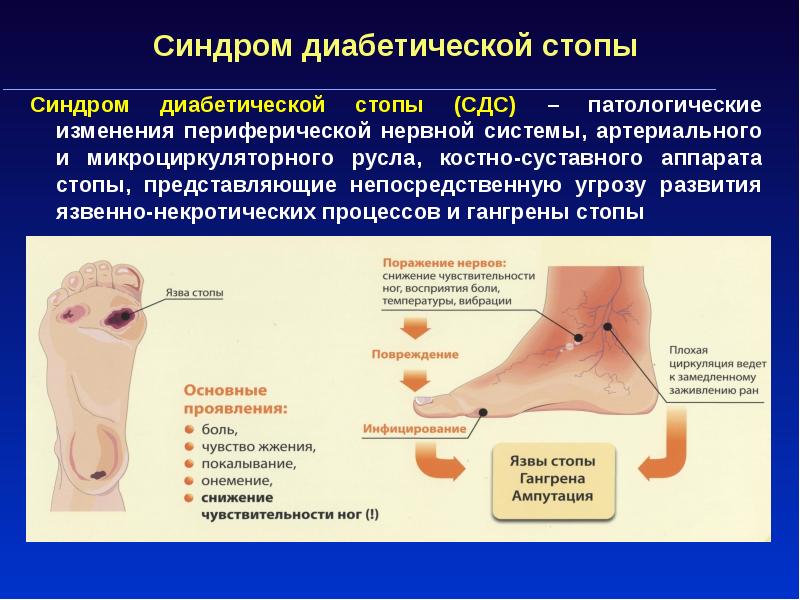 Сахарный диабет 1 и 2 типа презентация