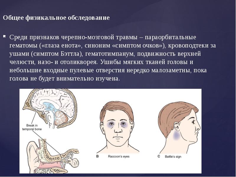 Карта вызова смп перелом основания черепа