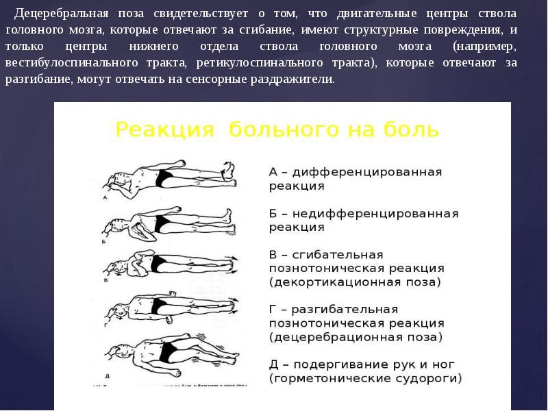 Нарушение сознания диагностика. ДЕЦЕРЕБРАЦИЯ И декортикация. Поза децеребрационной ригидности. Децеребральная ригидность у человека. Положение декортикации.