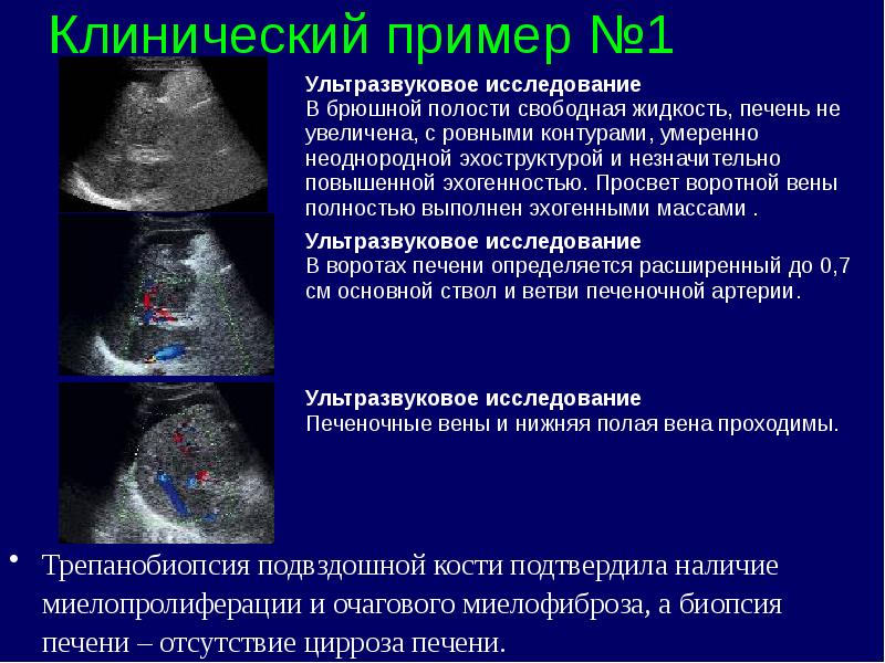 Хронические миелопролиферативные заболевания презентация