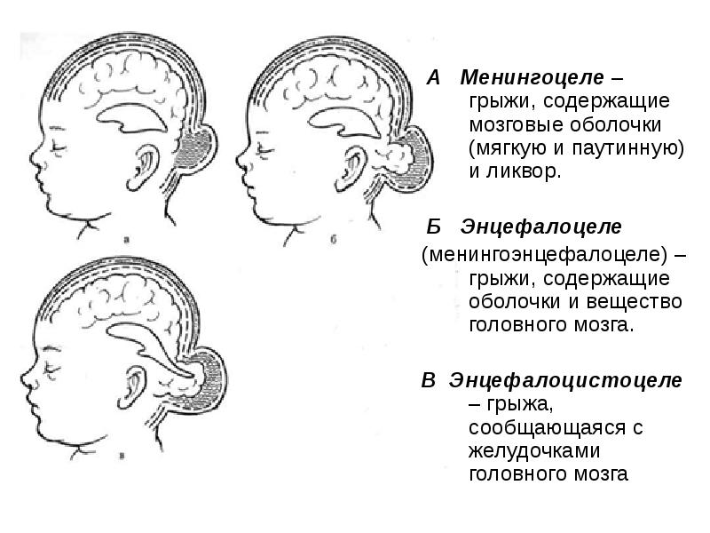 Расщелины лица презентация