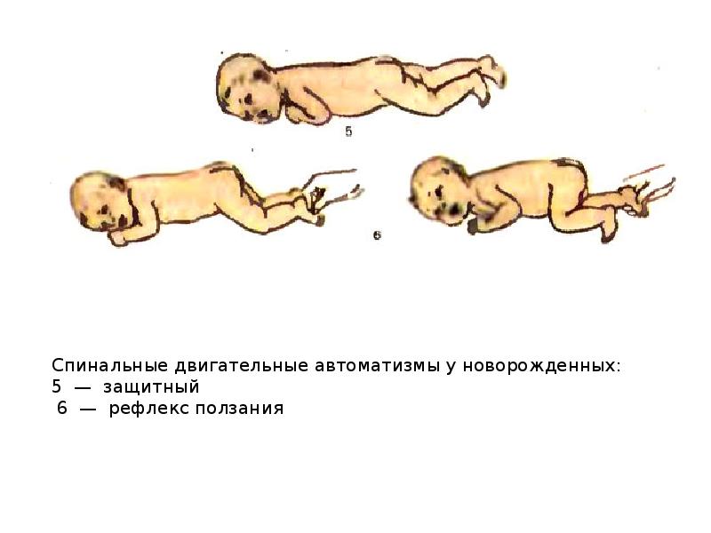 Рефлексы новорожденных презентация