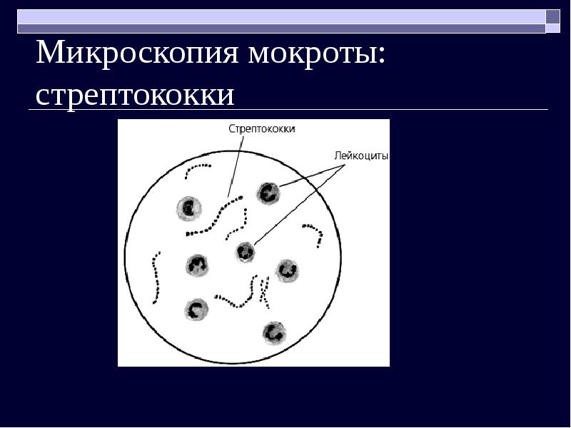 Микроскопия мокроты в картинках с описанием