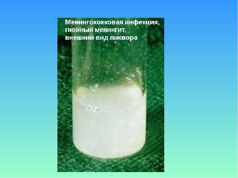Набухание кожи в воде как называется. Реакция набухания капсулы. раствор предварительное набухание. цвет раствора предварительное набухание. является ли набухание специфическим процессом.