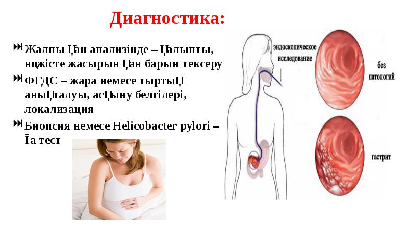 Диагностика:
Жалпы қан анализінде – қалыпты, нәжісте жасырын қан барын тексеру
Диагностика:
Жалпы қан анализінде – қалыпты, нәжісте жасырын қан барын тексеру