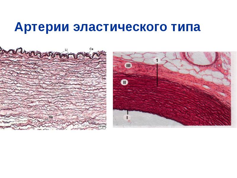 Рисунок артерия эластического типа