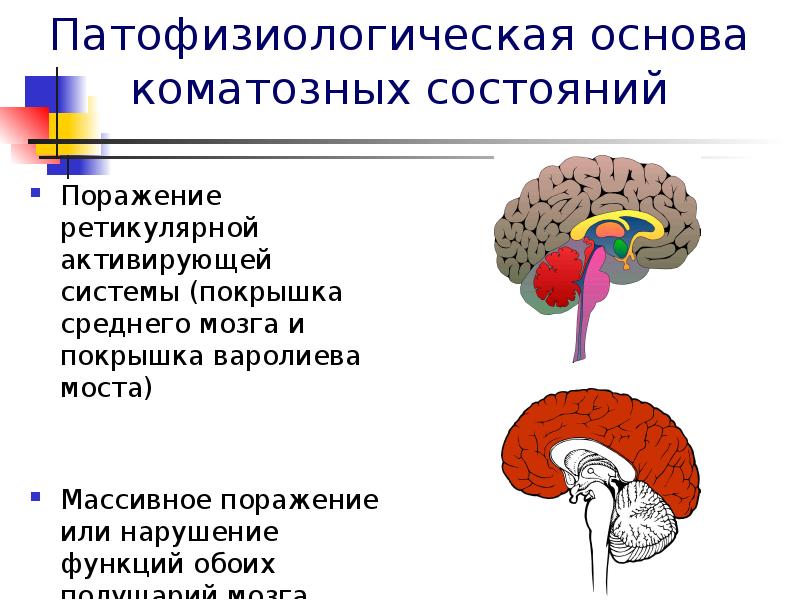 Презентация варолиев мост