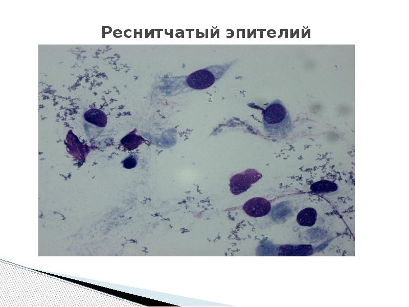 Реснитчатый эпителий Реснитчатый эпителий